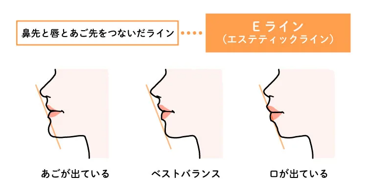 横顔美人の条件は？医師が教える、美しい横顔になるための方法｜美容知識コラム｜アラガン・エステティックス・ビューティー