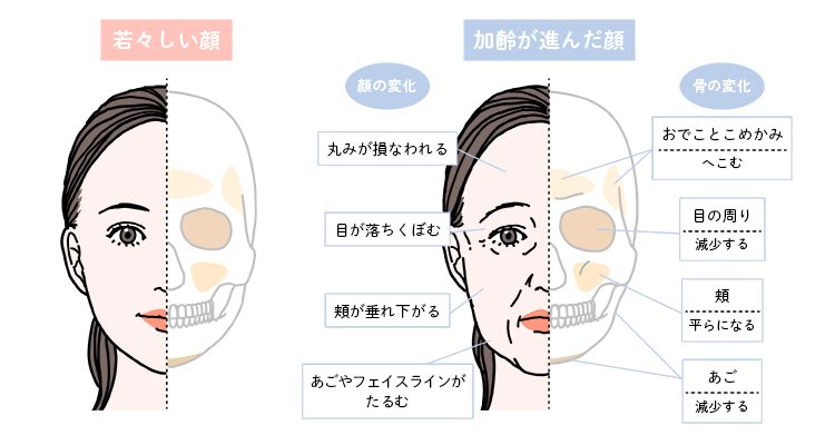 加齢による骨内部の変化