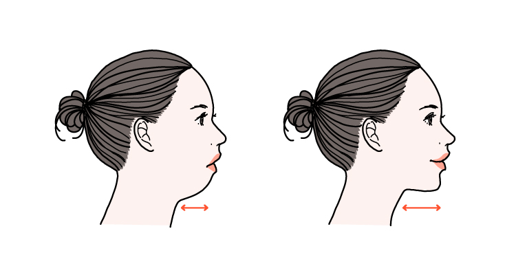 顎が小さいことで二重あごに見えやすくなる
