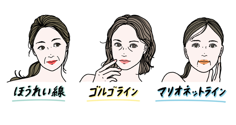 ナイアシンアミドはたるみじわの改善は期待しにくい