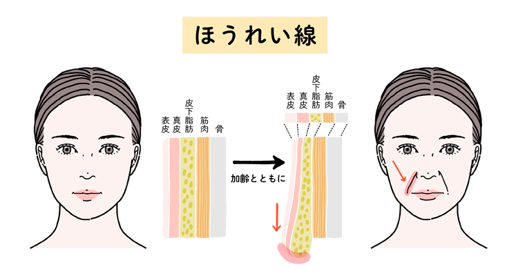 ほうれい線ができるメカニズムイメージ