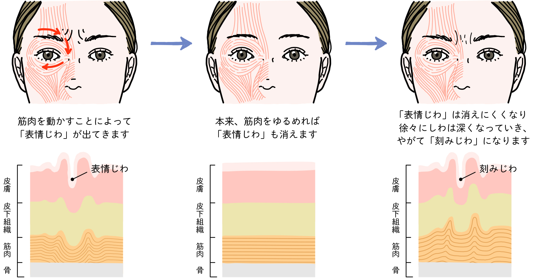 表情じわのメカニズム