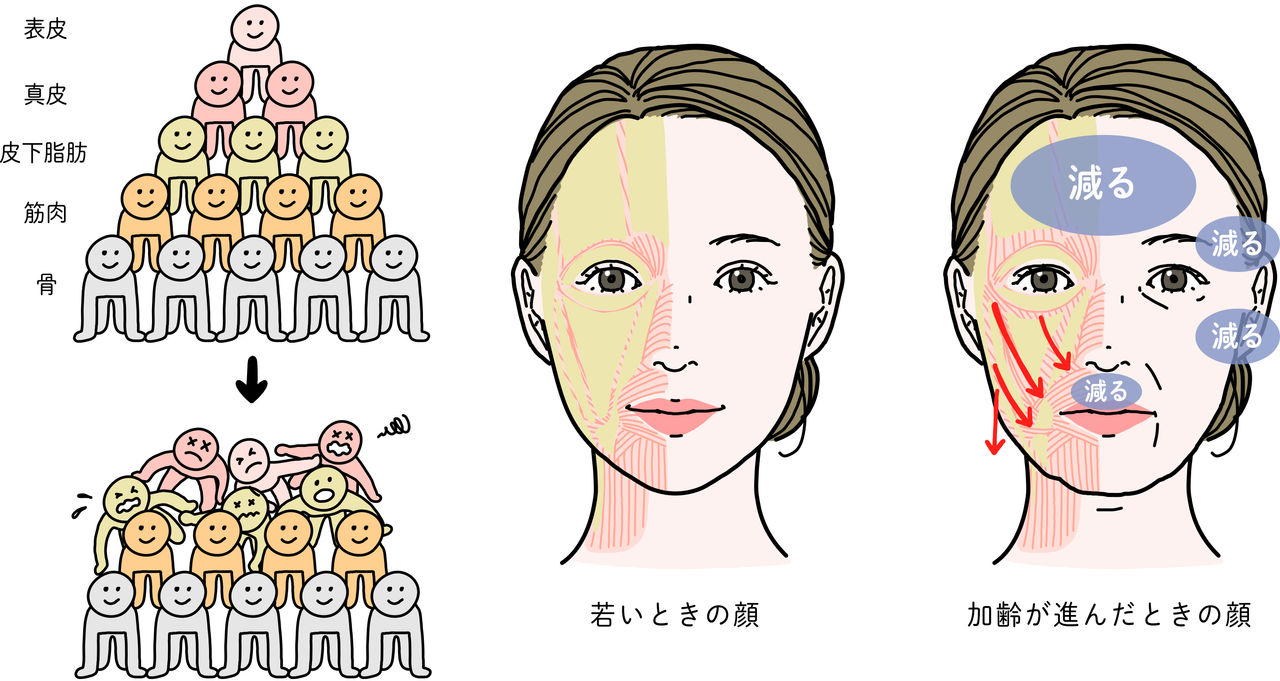 加齢が進むと皮下脂肪の量が減少する